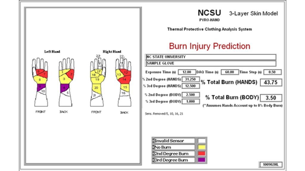 Pyrography Kit Injuries PyroHands™ | NC State's Milliken Textile Protection and Comfort Center